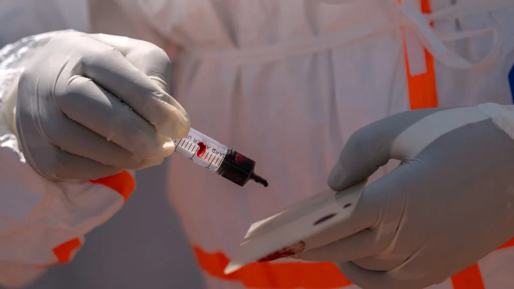 Addressing Diagnostic Gaps in Ebola and Marburg Outbreak Response