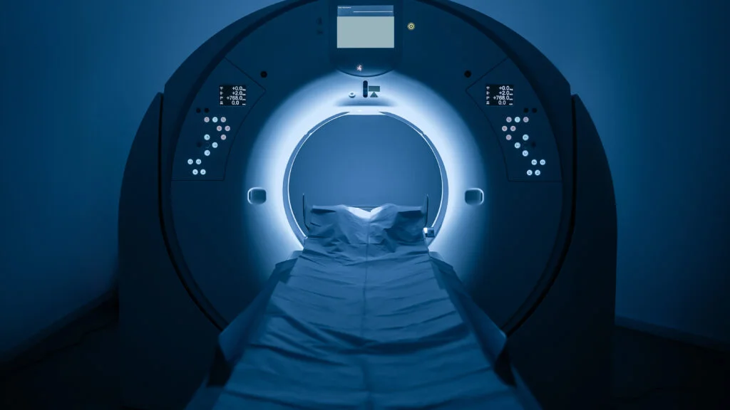 Rethinking Prostate Cancer Diagnosis: The Role of MRI vs. Traditional Methods