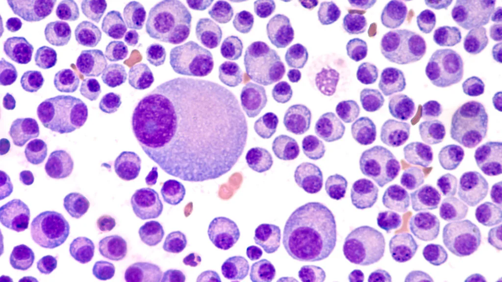 Bristol Myers Squibb's Zenbexus Breaks New Ground in Multiple Myeloma Treatment