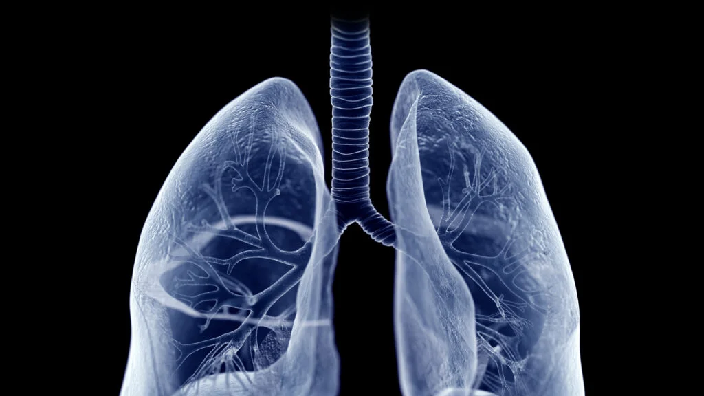 Roivant's Mosliciguat Shows Promising Results in Mid-Stage Study for Pulmonary Hypertension