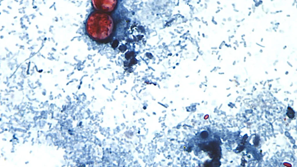 Investigating the End of America’s Largest Cyclospora Outbreak: Questions Remain